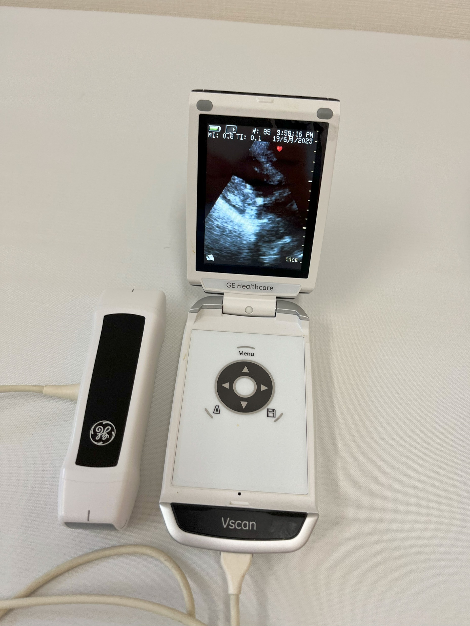 携帯型エコー検査